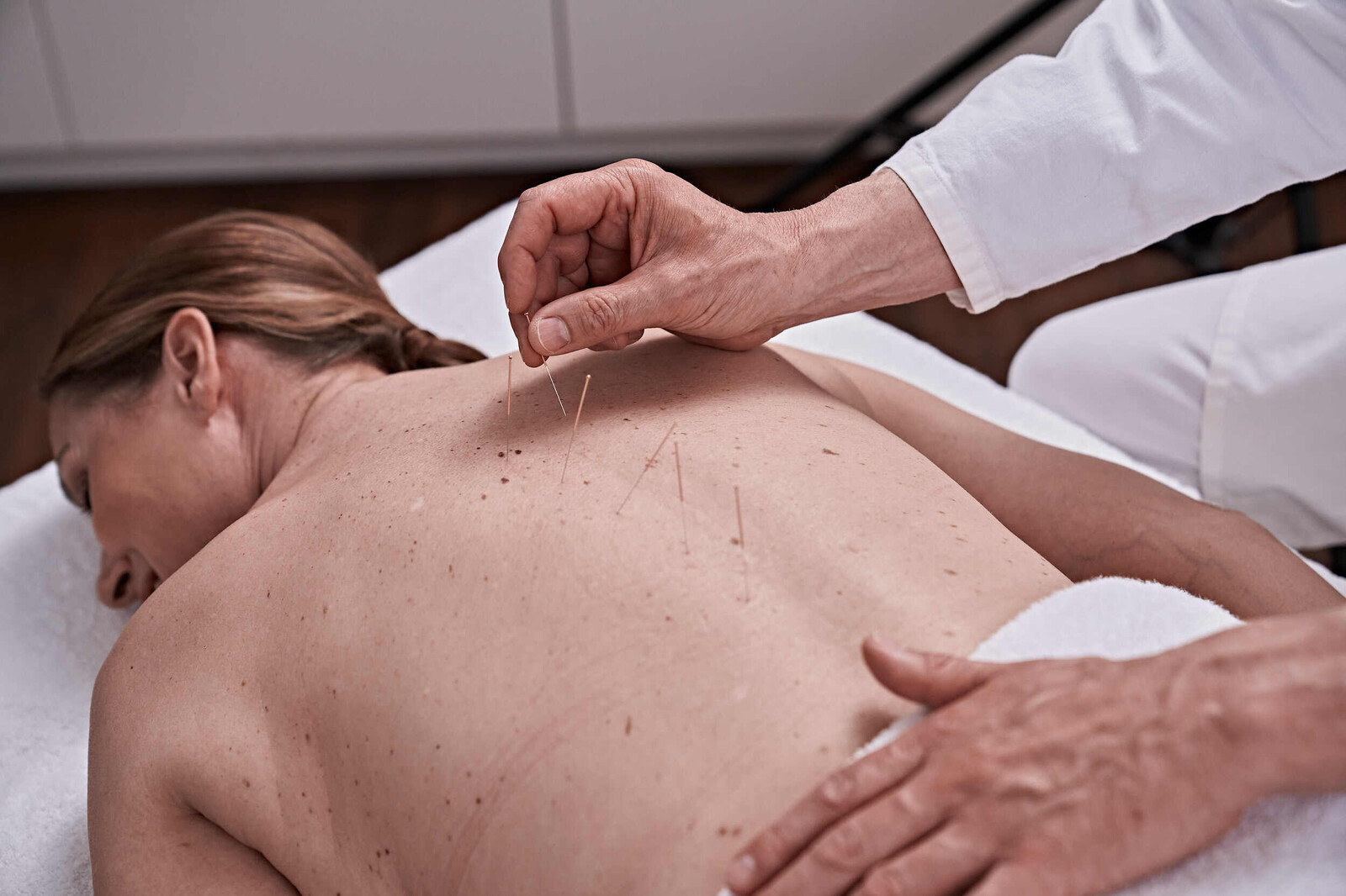 A, Traditional acupuncture: manual manipulation of an inserted needle